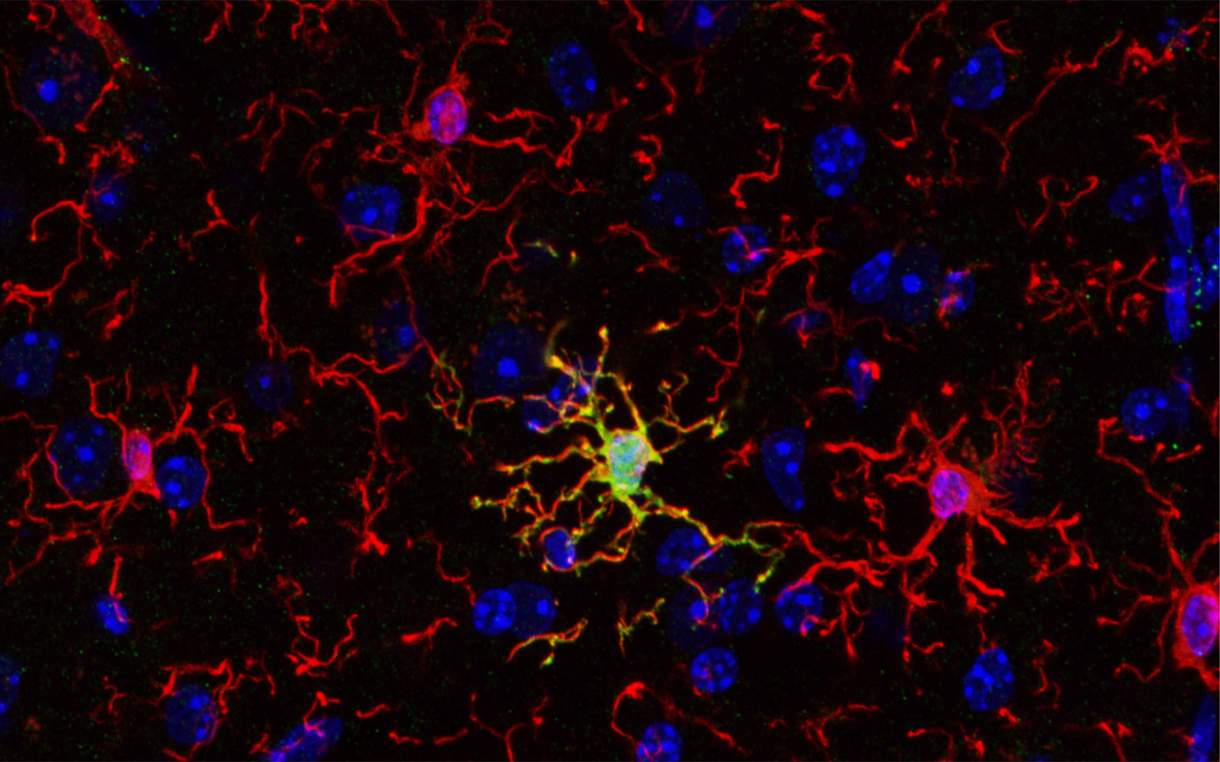 :TUTKIMUS: Aivojen immuunisolut eroavat toisistaan – voi avata uusia tapoja hoitaa aivosairauksia