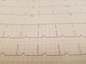 Sydänliitto uudistaa strategiansa – vahva ja vaikuttava toimija sydänterveyden puolesta